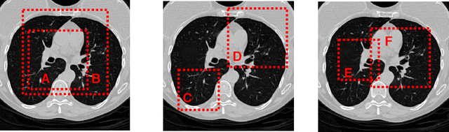 Figure 3 for Momentum Contrastive Learning for Few-Shot COVID-19 Diagnosis from Chest CT Images