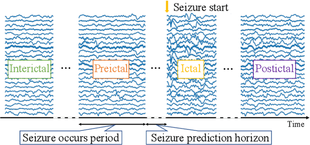 Figure 1 for A Novel Multi-scale Dilated 3D CNN for Epileptic Seizure Prediction