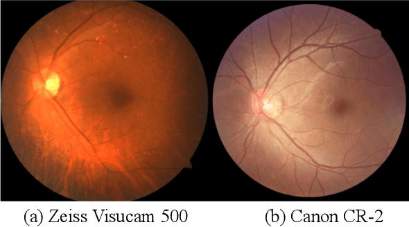 Figure 1 for CADA: Multi-scale Collaborative Adversarial Domain Adaptation for Unsupervised Optic Disc and Cup Segmentation