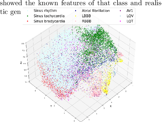 Figure 2 for Interpretable ECG classification via a query-based latent space traversal (qLST)