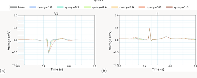 Figure 4 for Interpretable ECG classification via a query-based latent space traversal (qLST)