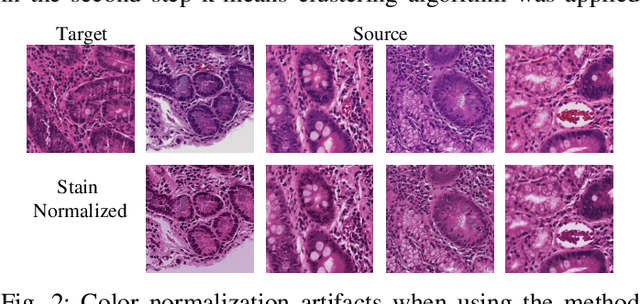 Figure 2 for CeliacNet: Celiac Disease Severity Diagnosis on Duodenal Histopathological Images Using Deep Residual Networks