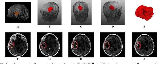 Figure 3 for Template-Cut: A Pattern-Based Segmentation Paradigm