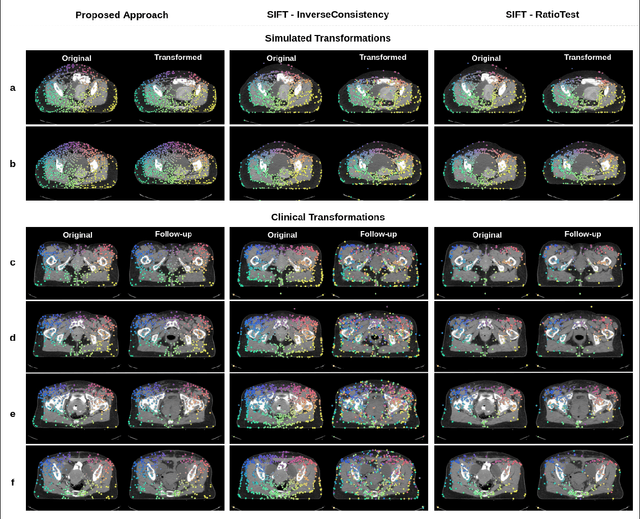 Figure 4 for An End-to-end Deep Learning Approach for Landmark Detection and Matching in Medical Images