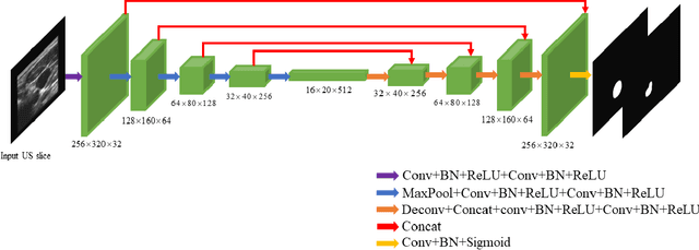 Figure 2 for Segmentation of common and internal carotid arteries from 3D ultrasound images using adaptive triple U-Net