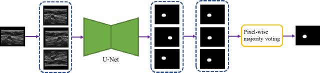 Figure 3 for Segmentation of common and internal carotid arteries from 3D ultrasound images using adaptive triple U-Net