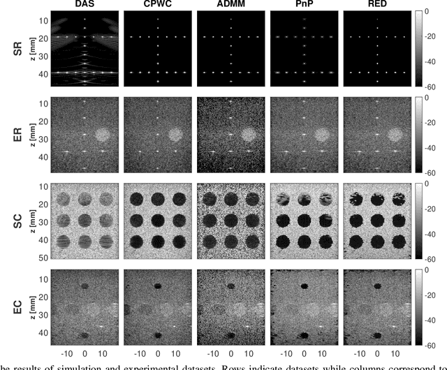 Figure 2 for Inverse Problem of Ultrasound Beamforming with Denoising-Based Regularized Solutions