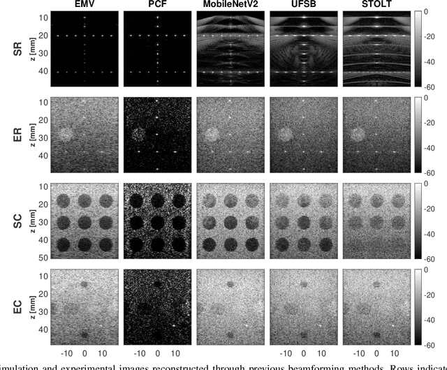 Figure 4 for Inverse Problem of Ultrasound Beamforming with Denoising-Based Regularized Solutions