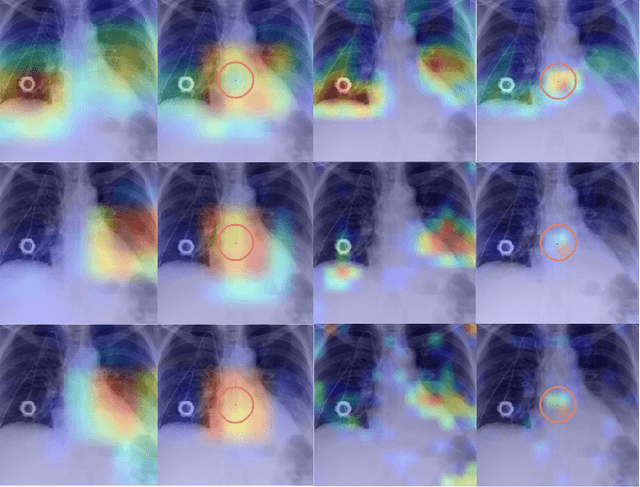Figure 1 for Explainability Matters: Backdoor Attacks on Medical Imaging