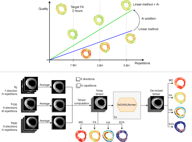 Figure 1 for Faster Diffusion Cardiac MRI with Deep Learning-based breath hold reduction