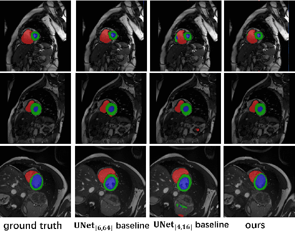 Figure 3 for ACT-Net: Asymmetric Co-Teacher Network for Semi-supervised Memory-efficient Medical Image Segmentation