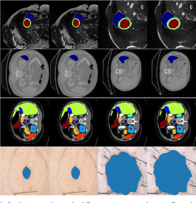 Figure 4 for The Fully Convolutional Transformer for Medical Image Segmentation