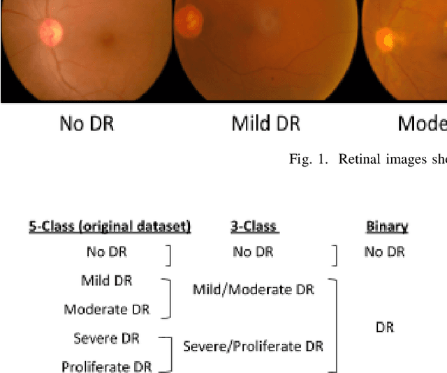 Figure 2 for Conversion and Implementation of State-of-the-Art Deep Learning Algorithms for the Classification of Diabetic Retinopathy