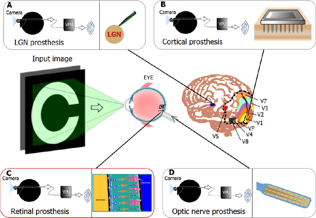 Figure 1 for Assessing visual acuity in visual prostheses through a virtual-reality system