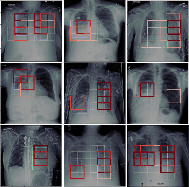 Figure 4 for Localization of Critical Findings in Chest X-Ray without Local Annotations Using Multi-Instance Learning