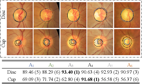 Figure 3 for Modeling Human Preference and Stochastic Error for Medical Image Segmentation with Multiple Annotators