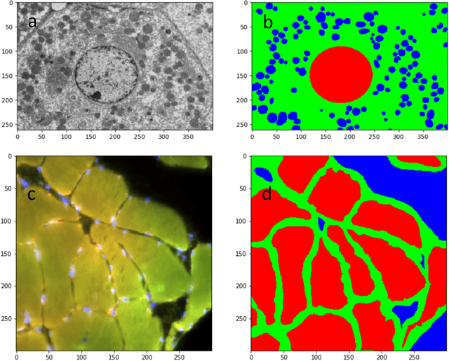 Figure 1 for Res-CR-Net, a residual network with a novel architecture optimized for the semantic segmentation of microscopy images