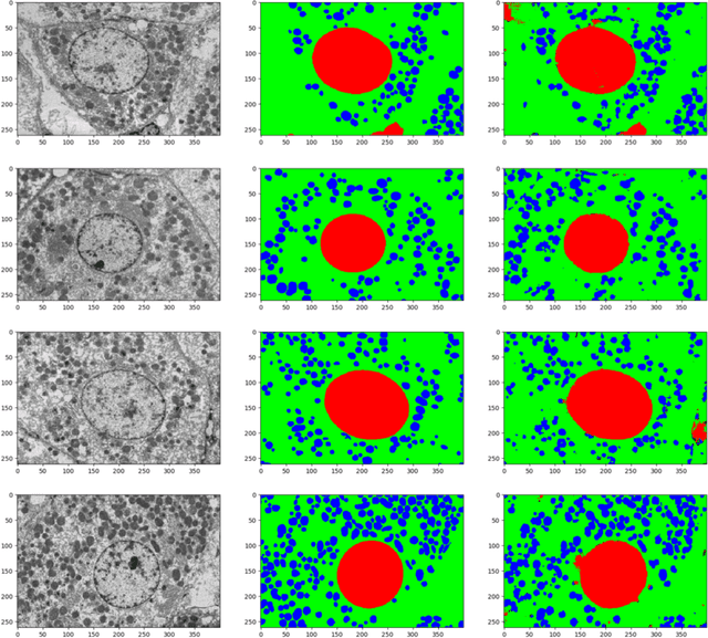 Figure 4 for Res-CR-Net, a residual network with a novel architecture optimized for the semantic segmentation of microscopy images