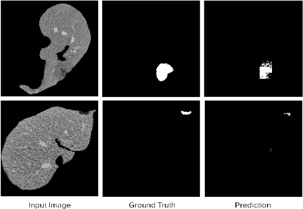 Figure 3 for Segmentation of Liver Lesions with Reduced Complexity Deep Models