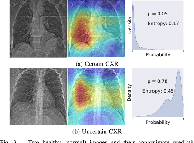 Figure 3 for Objective Evaluation of Deep Uncertainty Predictions for COVID-19 Detection