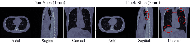 Figure 1 for AlignShift: Bridging the Gap of Imaging Thickness in 3D Anisotropic Volumes