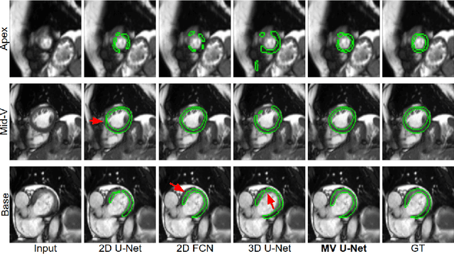 Figure 4 for Learning Shape Priors for Robust Cardiac MR Segmentation from Multi-view Images