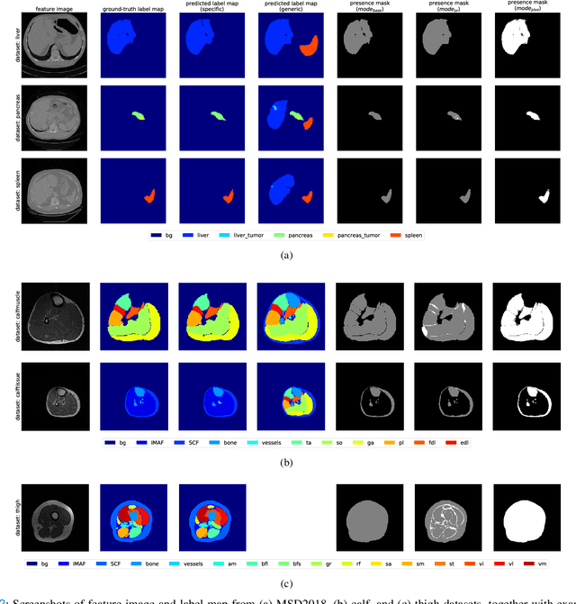 Figure 2 for Training CNN Classifiers for Semantic Segmentation using Partially Annotated Images: with Application on Human Thigh and Calf MRI
