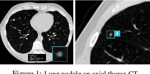 Figure 1 for 3D G-CNNs for Pulmonary Nodule Detection