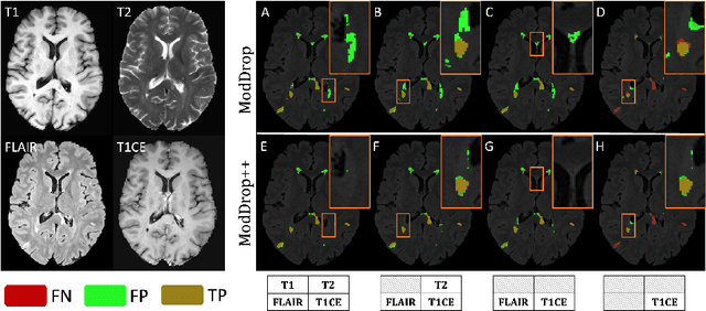 Figure 4 for ModDrop++: A Dynamic Filter Network with Intra-subject Co-training for Multiple Sclerosis Lesion Segmentation with Missing Modalities