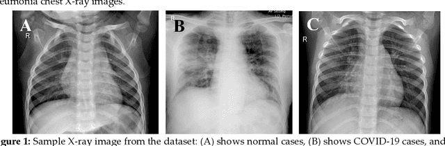 Figure 1 for Can AI help in screening Viral and COVID-19 pneumonia?