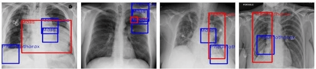 Figure 4 for AI in Telemedicine: An Appraisal on Deep Learning-Based Approaches to Virtual Diagnostic Solutions (VDS)