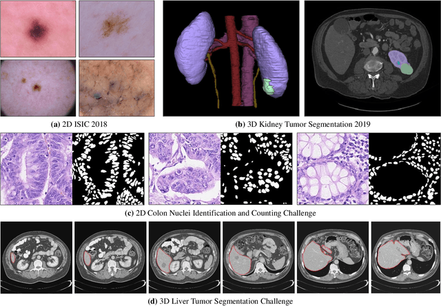 Figure 4 for Deep Learning for Medical Image Segmentation: Tricks, Challenges and Future Directions