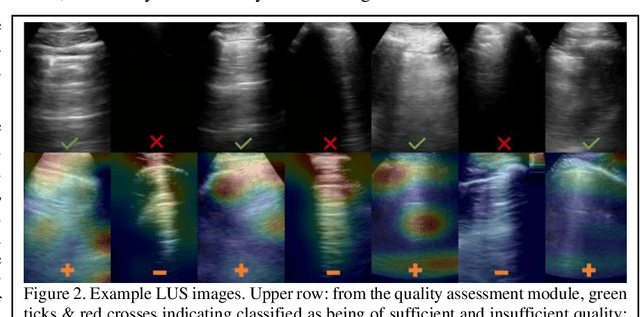 Figure 2 for Image quality assessment for closed-loop computer-assisted lung ultrasound