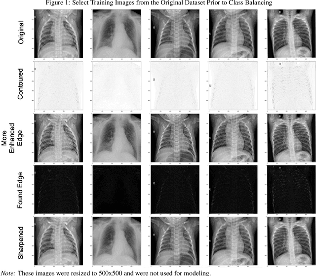 Figure 1 for In-Line Image Transformations for Imbalanced, Multiclass Computer Vision Classification of Lung Chest X-Rays
