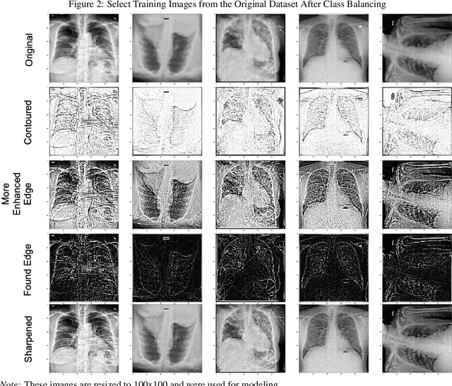 Figure 3 for In-Line Image Transformations for Imbalanced, Multiclass Computer Vision Classification of Lung Chest X-Rays