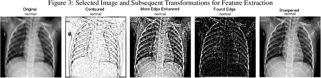Figure 4 for In-Line Image Transformations for Imbalanced, Multiclass Computer Vision Classification of Lung Chest X-Rays
