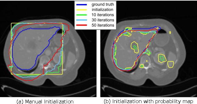 Figure 3 for A deep level set method for image segmentation