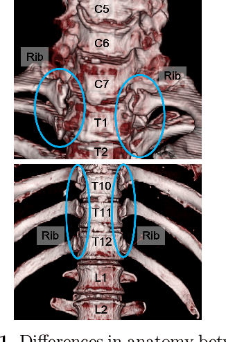 Figure 1 for Automatic Segmentation, Localization, and Identification of Vertebrae in 3D CT Images Using Cascaded Convolutional Neural Networks