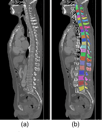 Figure 3 for Automatic Segmentation, Localization, and Identification of Vertebrae in 3D CT Images Using Cascaded Convolutional Neural Networks