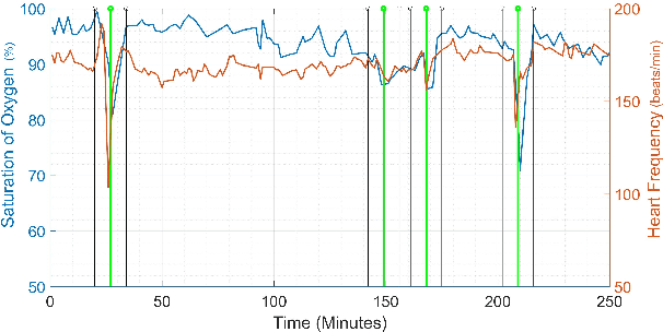 Figure 1 for Large Neural Network Based Detection of Apnea, Bradycardia and Desaturation Events