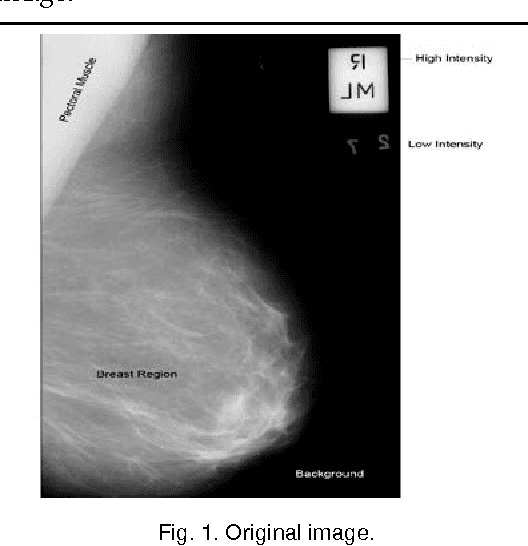 Figure 1 for Automatic Mammogram image Breast Region Extraction and Removal of Pectoral Muscle