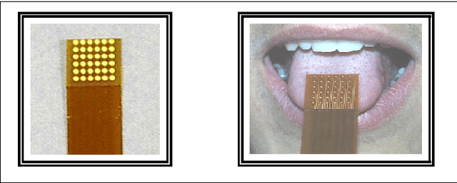Figure 2 for Utilisation de la substitution sensorielle par électro-stimulation linguale pour la prévention des escarres chez les paraplégiques. Etude préliminaire