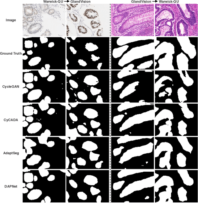 Figure 4 for Dual Adaptive Pyramid Network for Cross-Stain Histopathology Image Segmentation