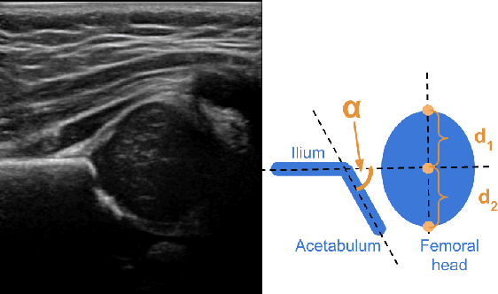 Figure 1 for Sample Efficient Learning of Image-Based Diagnostic Classifiers Using Probabilistic Labels