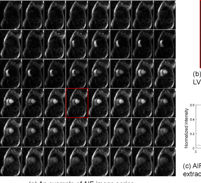 Figure 1 for Automated Detection of Left Ventricle in Arterial Input Function Images for Inline Perfusion Mapping using Deep Learning: A study of 15,000 Patients