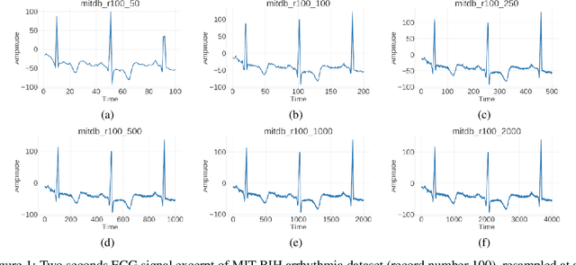 Figure 1 for Choosing a sampling frequency for ECG QRS detection using convolutional networks