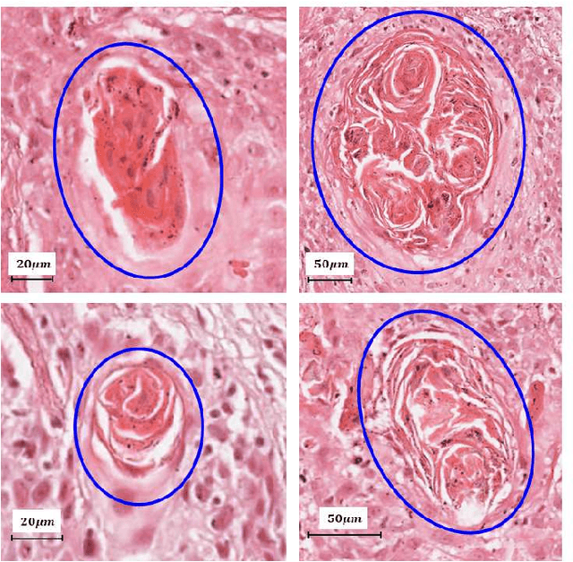 Figure 1 for On Smart Gaze based Annotation of Histopathology Images for Training of Deep Convolutional Neural Networks