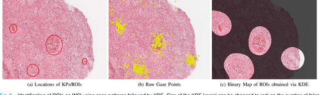 Figure 4 for On Smart Gaze based Annotation of Histopathology Images for Training of Deep Convolutional Neural Networks