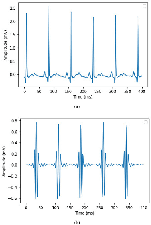Figure 2 for A novel deep learning-based approach for sleep apnea detection using single-lead ECG signals