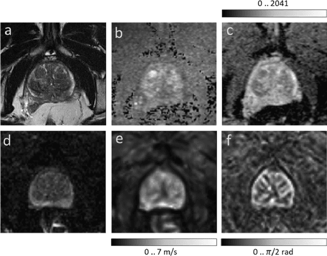 Figure 1 for Fully automated quantification of in vivo viscoelasticity of prostate zones using magnetic resonance elastography with Dense U-net segmentation
